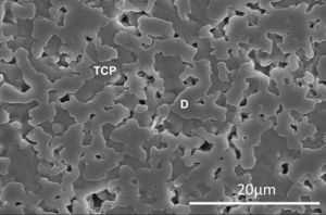 Low magnification FE-SEM microphotograph of the polished and thermically etched surface (1100°C) of 60wt% Ca3(PO4)2–40wt% CaMg(SiO3)2 composition sintered 4h at 1225°C. TCP correspond to tricalcium phosphate phase and D to the diopside [96].