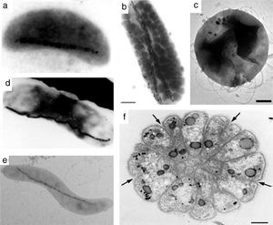Various morphology of magnetotactic bacteria: (a) vibrios, (b, d) rods (b marker=1μm), (c) coccoid (c marker=200nm), (e) spirilla, and (f) multicellular organism (f marker=1μm). Black nanostructures in micrographs are IONPs. Reprinted with permission from [91].