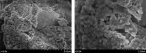 Microfotografías de cristales de cloruro sódico en la muestra ME 19.