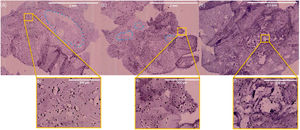 The H&E visualization of harvested scaffolds from animal models. The In vivo cell migration and attachment on the scaffolds is evident after (a, b) 5 days, (c, d) 10 days, and (e, f) 15 days.