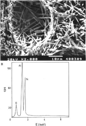 Selected SEM micrograph of the pyrophyllite clay sample fired at 1300°C for 1h after chemical etching (a) using aqueous HF (20wt.%) and the corresponding EDS analysis (b) of this sample.