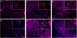 Fluorescence staining of the nuclei (blue) and cytoskeleton (red) of the MG-63 cells on the surface of the core (A, B), and scaffolds 3J (C, D) and 3S (E, F) after 3 and 7 days.