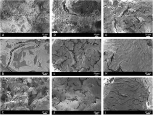 SEM images of the core (A, D, G) and scaffolds 3J (B, E, H) and 3S (C, F, I) after 3 (A–C), 14 (D–F) and 21 days (G–I) of immersion in the CCM with MG-63 cells.