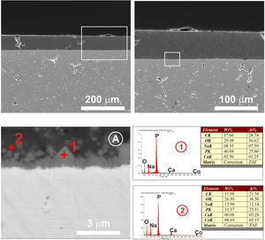 Cross section at different magnifications of the 3wt.% MgO zirconia substrate coated with the glass doped with 1wt.% cobalt oxide. EDX microanalyses taken in different areas of the interface are showed. In (A) the calcium phosphate microcrystals can be seen in the contact zone between the two dissimilar surfaces.