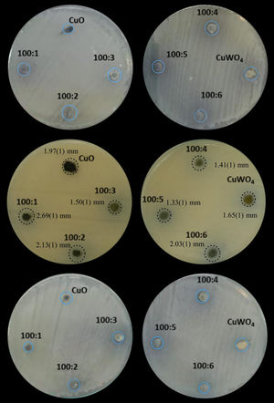 Results of the inhibition zones for (a) Pseudomonas aeruginosa, (b) Escherichia coli, and (c) Salmonella enteritidis, obtained through antibiogram method application.