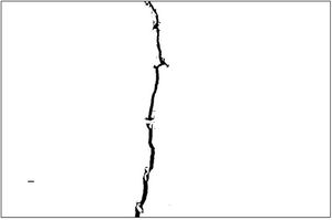 Appearance of the crack after the shape analysis.