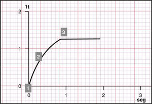 Criterios de aceptabilidad curva volumen/tiempo.1.Volumen de extrapolación retrógrada.2.Ascenso.3.Tiempo espiratorio. En este caso es de 0,8 segundos.