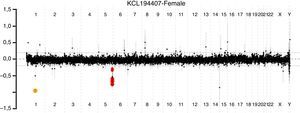 Análisis cromosómico por microarreglos de alta resolución de todo el material genético. Los puntos negros indican material genético en parámetros normales, sin exceso o déficit. En rojo se muestra pérdida de material genético del brazo largo del cromosoma 5, de 2.082 MB correspondiente a la región 5q35.2 q35.3 que incluye el gen NSD1.