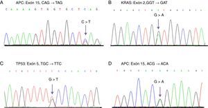 Cromatogramas obtenidos del secuenciamiento directo que muestra diferentes mutaciones identificadas. A) Mutación en APC detectada en una muestra de CCR. B) Mutación en KRAS identificada en muestras de CE y CCR. C) Mutación en TP53 encontrada en un caso de CE. D) Polimorfismo p.T1493T en APC detectado con una alta frecuencia en pacientes con CE y CCR. Las flechas muestran el sitio del cambio de base.