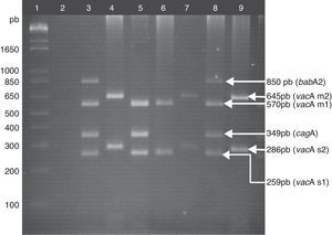 Genotipificación de H. pylori. Carril 1: marcador de peso molecular de 1kb plus; carril 2: control negativo; carril 3: control positivo, ADN de la cepa J99 de H. pylori, genotipo vacAs1m1/cagA+/babA2+; carril 4, 7 y 9: muestras clínicas genotipo vacAs2m2/cagA–/babA2–; carril 5: muestra clínica genotipo vacAs1m1/cagA+/babA2–; carril 6: muestra clínica genotipo vacAs1m1/cagA–/babA2–; carril 8: muestra clínica genotipo vacAs1m1/cagA+/babA2+. Gel de agarosa al 2.5%.