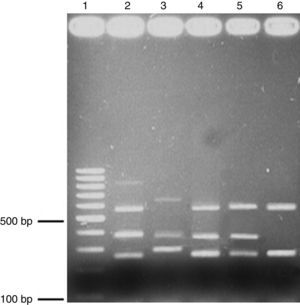 PCR multiplex. Electroforesis en gel de agarosa (1.7%); muestra los amplicones obtenidos a través de PCR multiplex. Carril 1, 100-bp escalera; carril 2, control positivo de cepas de virulencia triple, carriles 3-6, aislados clínicos. babA2 (812bp); vacAs1 (259bp); vaAs2 (286bp); vacAm1 (570bp); vacAm2 (645bp) y cagA (340bp). El ADN genómico de la cepa H. pylori ATCC 43504 se utilizó como control positivo.