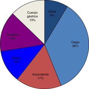 Localización de angiodisplasias sobre el total del tracto digestivo.