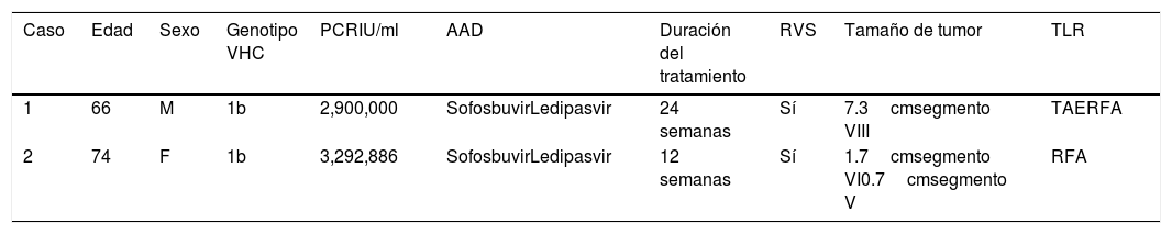 Tablas
