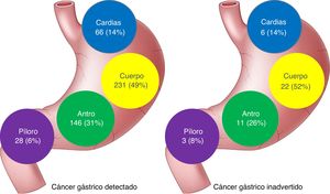 Ubicación y frecuencia de las lesiones en la EGD.