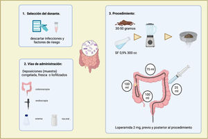 Proceso de trasplante microbiota fecal. Previo al procedimiento se realiza una entrevista y examen físico a posibles donantes en búsqueda de factores de riesgo, comorbilidades y antecedentes familiares para posteriormente estudiarse según protocolo local de nuestro centro descartando diversas infecciosas eventualmente trasmisibles. En la imagen se puede observar el procedimiento estandarizado en nuestro centro con 30 a 50 g de deposiciones del donante que se diluyen en 300mL de suero fisiológico para posteriormente ser procesados y administrados mediante colonoscopia con distribución 100mL en íleon terminal, 100mL en colon derecho, 75mL en colon transverso y 25mL en colon izquierdo. Previo a examen y posterior a este se administra loperamida para disminuir el tiempo de tránsito intestinal.