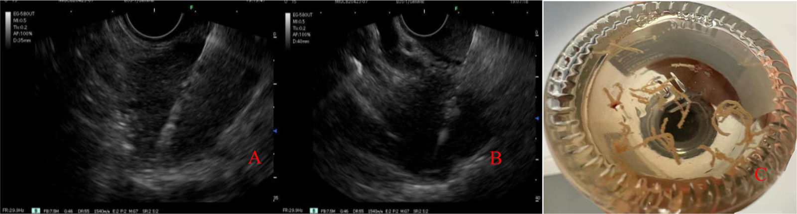 fig0010