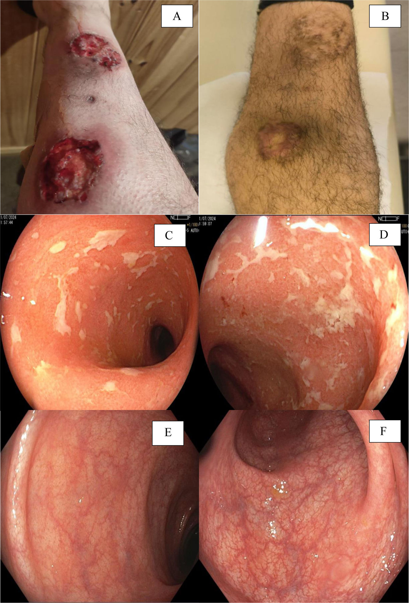 fig0005