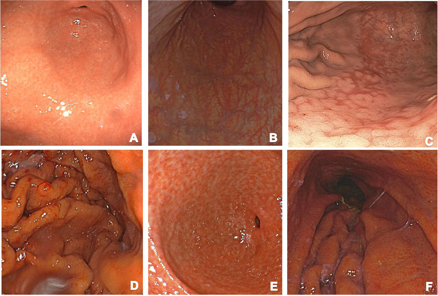 fig0005