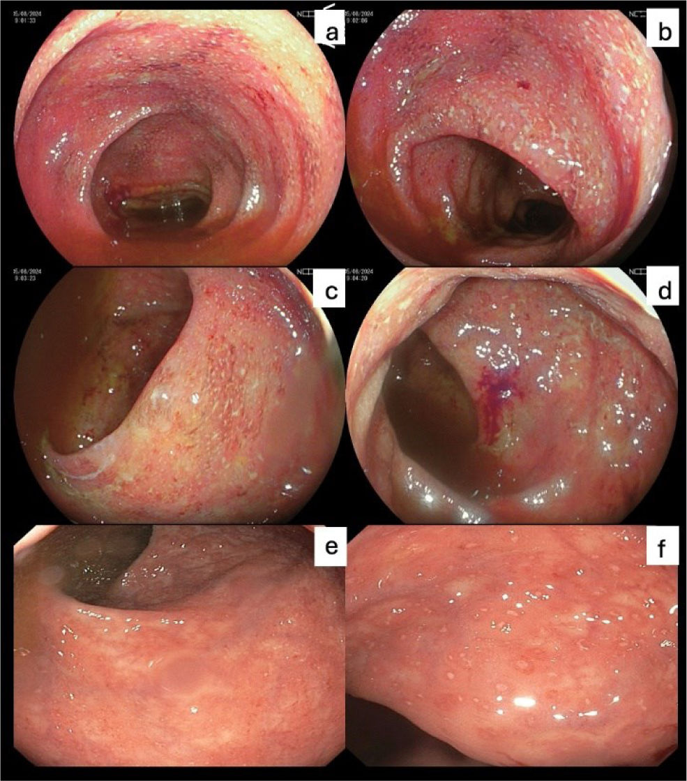fig0005