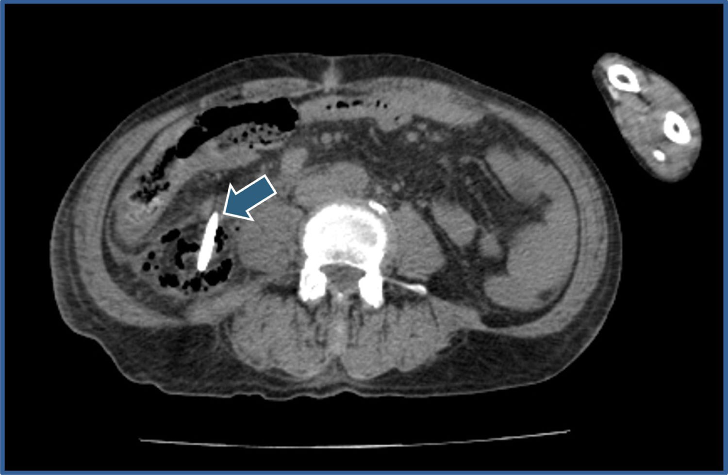fig0010