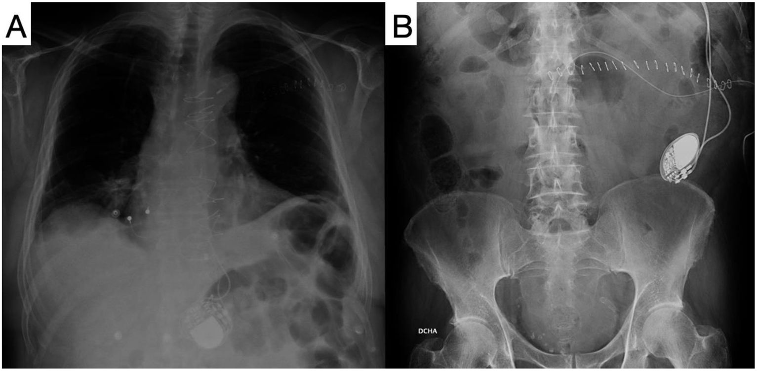fig0005
