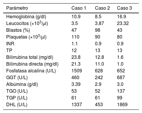 Tablas