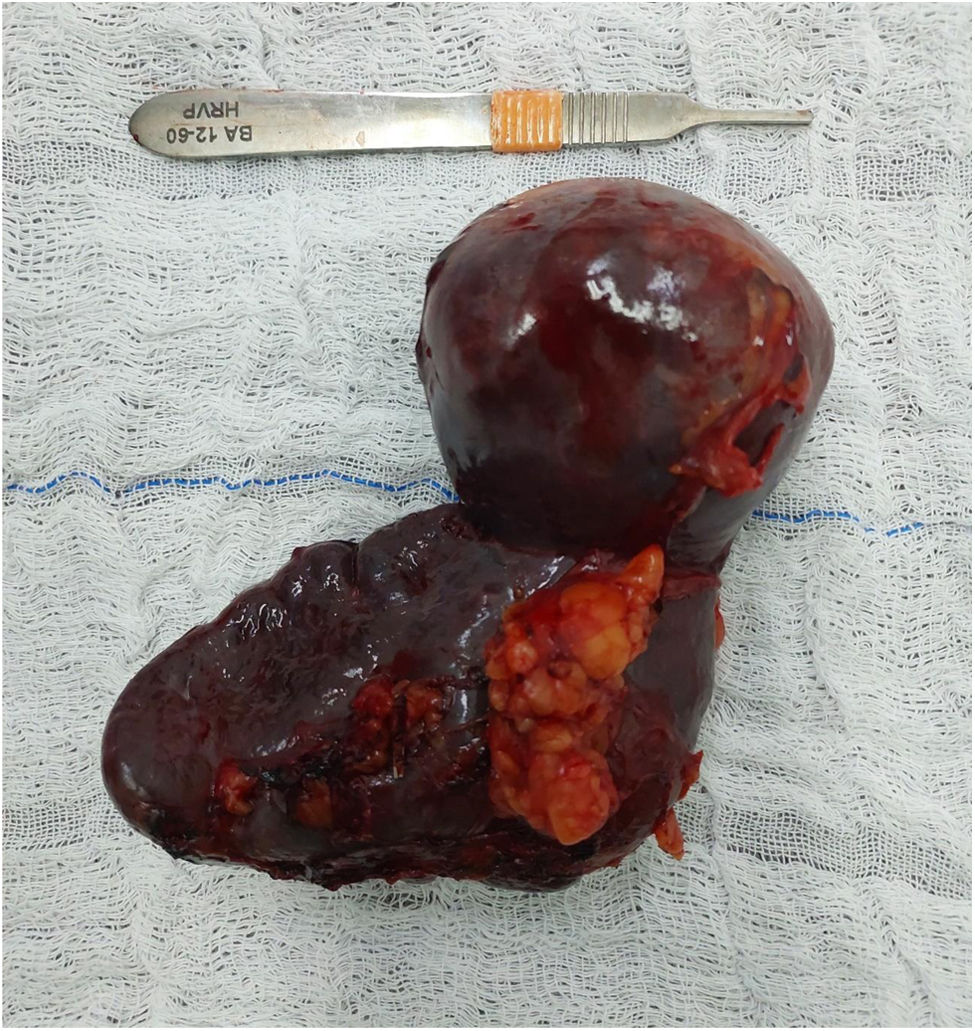 fig0010