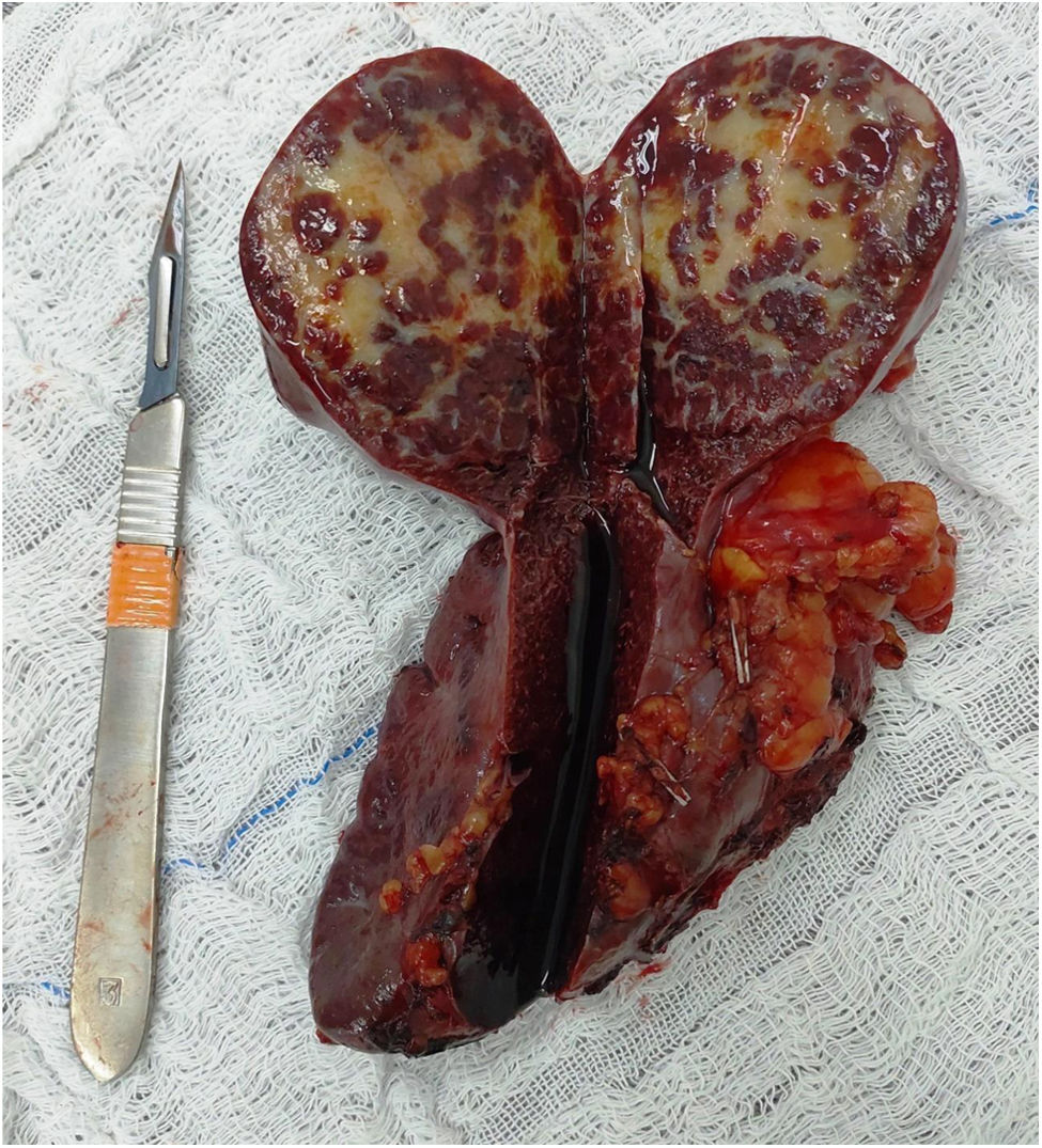 fig0015
