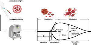 Parámetros de la tromboelastografía58. La tromboelastografía (TEG) nos proporciona varios parámetros: • Tiempo R. Definido como el tiempo del inicio del trazo del TEG hasta que la amplitud del trazo alcanza 2mm (normal: 5-10min); representa la tasa de la formación inicial del coágulo (fase de iniciación). Se relaciona primariamente con la actividad de los factores de coagulación procoagulantes y anticoagulantes. Su prolongación es resultado de deficiencias de factores de coagulación o hipofibrinogenemia severa. • Tiempo K. Definido como el tiempo del «Tiempo R» hasta que la amplitud del trazo alcanza 20mm (normal: 1-3min); representa una formación dinámica del coágulo (fase de amplificación) y está relacionado con la actividad de los factores de coagulación, fibrinógeno y plaquetas. • α. Es el ángulo de la línea tangencial del trazo en desarrollo (rango normal: 53° a 72°); mide la velocidad en la que el entrecruzamiento de la fibrina ocurre (fase de propagación de trombina) y la función de las plaquetas y factores plasmáticos en la superficie de las plaquetas. • AM. La amplitud máxima del trazo del TEG (normal: 50-70mm) refleja la fuerza máxima del coágulo (estabilidad general del coágulo) y refleja directamente la interacción de la función plaquetaria y los factores de coagulación plasmáticos. • LY30. Es el porcentaje de disminución en amplitud a 30 minutos después de la AM (normal 0-8%); refleja la disolución inicial del coágulo (fibrinólisis). Figura creada con Biorender.com. Modificada de Turco et al.59.