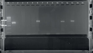 Electroforesis de los productos de PCR de 13 biopsias positivas para H. pylori en gel de agarosa al 2% utilizando los cebadores cag2F y CAGTR. Línea M: marcador de peso molecular; línea 1: control positivo; línea 2: control negativo; líneas 3-15: muestras de biopsias con H. pylori.
