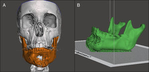 A, B) Selección de la región anatómica y edición del modelo.