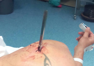 Imagen del paciente previo a la intervención quirúrgica.