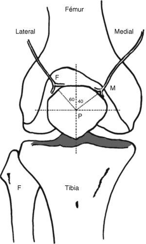 Aproximación hacia la rótula (P) de los nervios patelares medial y lateral en un ángulo de 60° y 40°, respectivamente.