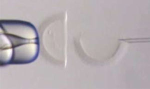 Test de Hemizona: se observan ambas hemizonas, que serán expuestas a espermatozoides del paciente y de un control.
