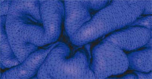 Imagen de mallado de la superficie cortical. Se visualizan los triángulos que aproxima a la morfología de los giros.