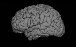 Imagen de postproceso que muestra vista lateral del hemisferio cerebral izquierdo en “solido”. Se ha extraído en scalp y cráneo.*