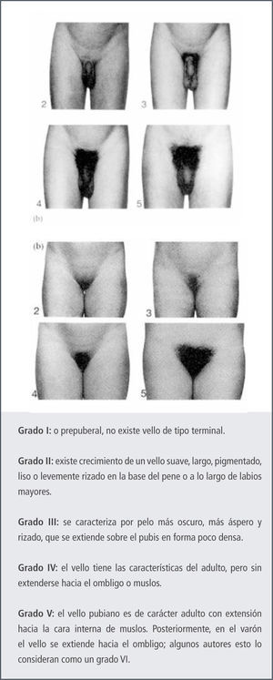 Secuencia de las etapas del desarrollo de los caracteres sexuales en vello pubiano en ambos sexos