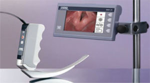 Videolaringoscopio C-Mac de Storz.