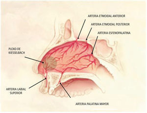 Plexo de Kiesselbach. Adaptado de Kucik C, Clenney T. Management of epistaxis Am Fam Physician 2005;71:305-11, 312.