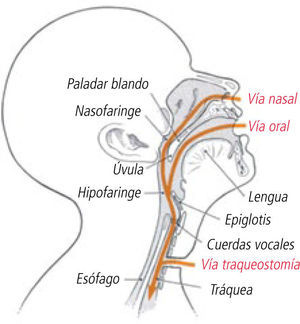 Accesos a la vía aérea.