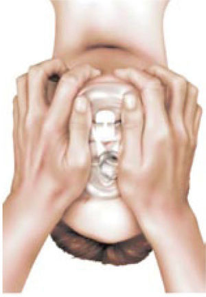 Técnica de Ventilación con mascarilla facial con dos manos.