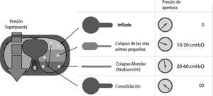 Espectro de presiones de apertura asociadas con las unidades pulmonares del pulmón injuriado. Modificado de Gattinoni.