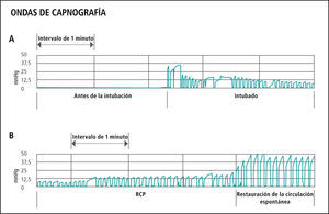 La onda de Capnografía para el registro cuantitativo del ETCO2 es la recomendación de las normas 2010 para los pacientes intubados durante todo el período del PCR, pues de esta forma también se confirma la adecuada colocación del TET (A), monitorización de la calidad del RCP y la detección del retorno de la circulación espontánea (B) (Aspectos destacados de las guías de la American Heart Association de 2010 para RCP y ACE © [2]).