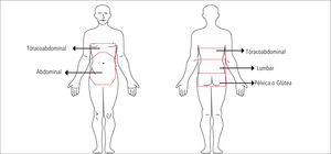 Límites de las áreas anatómicas del abdomen. (González y García).