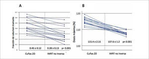 Inhomogeneidad en radioterapia de mama según técnica 2D con cuñas vs. IMRT con campos segmentados. A. Fracción del volumen mamario total incluido en la isodosis del 105% y B. Puntos de máxima dosis en mama (100%= dosis indicada).
