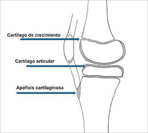 Distribución de tejido cartilaginoso en la rodilla de un niño (Modificado de O'Neill D, Micheli Lyle.: Lesiones por sobreuso en atletas jóvenes. http://www.g-se.com/pid/688/).
