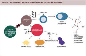 Algunos mecanismos patogénicos en artritis reumatoidea.