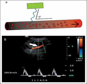 a.- El ángulo de incidencia se forma entre la dirección del haz y el flujo. Se denomina O. b.- Posición correcta del cursor (flecha) paralelo al flujo.