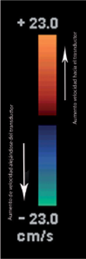 Barra de escala de color. El color superior (en este caso rojo) codifica el flujo que se acerca al transductor y el inferior, el que se aleja del transductor. Mientras más brillante es el color, mayor es la velocidad.