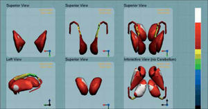 Figura 3